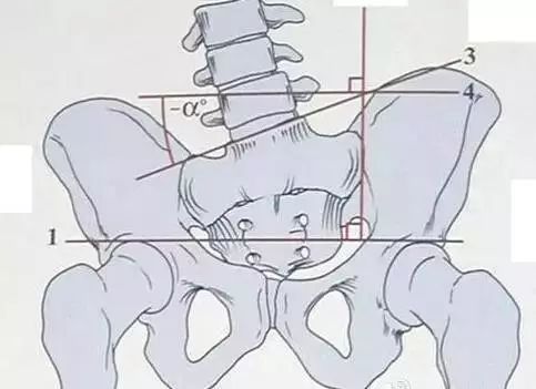 28岁腰已经废了怎么办,三十岁了腰就废了怎么办