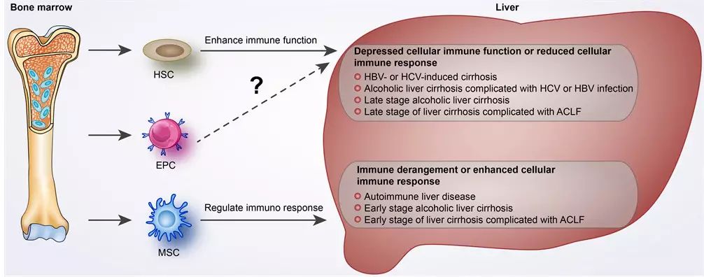 自身骨髓干细胞移植治疗肝硬化,肝硬化自体骨髓干细胞移植