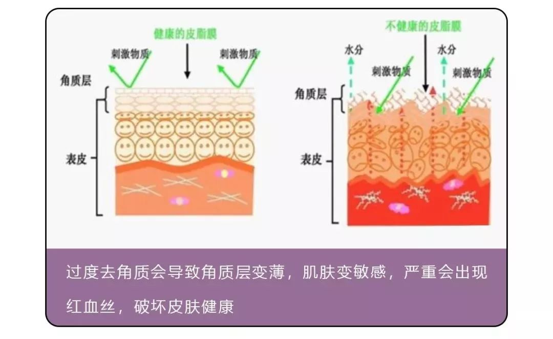 每天洗澡都能搓出泥是怎么回事,洗澡搓掉的像泥一样的东西是什么
