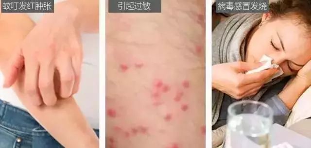 日本顶级灭蚊神器,日本变态灭蚊神器