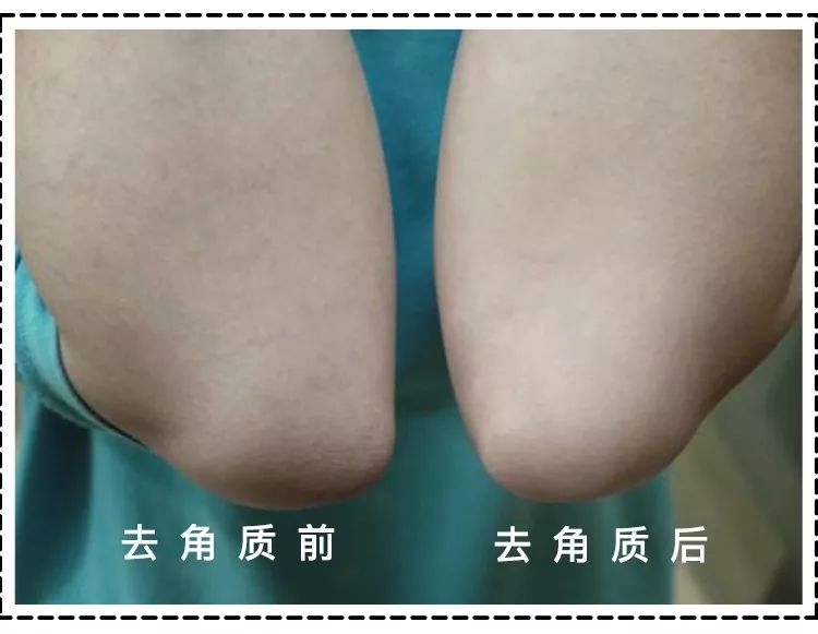 杨幂无法原谅的4位女明星,杨幂十大惊人照片