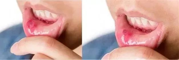 俄罗斯牙膏去黄牙怎么样,祛牙垢黄牙的牙膏国货之光