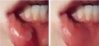 俄罗斯牙膏去黄牙怎么样,祛牙垢黄牙的牙膏国货之光