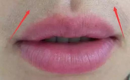 简单有效的脱毛膏,脱毛膏怎么快速去毛