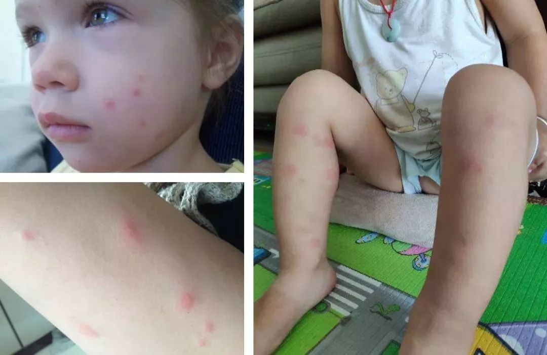 防蚊帘下面容易开,防蚊闭合帘