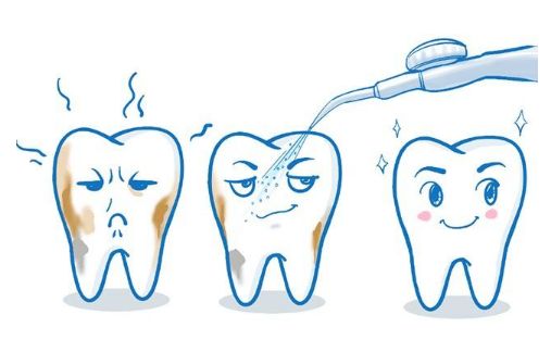 注意口腔问题,当心牙缝