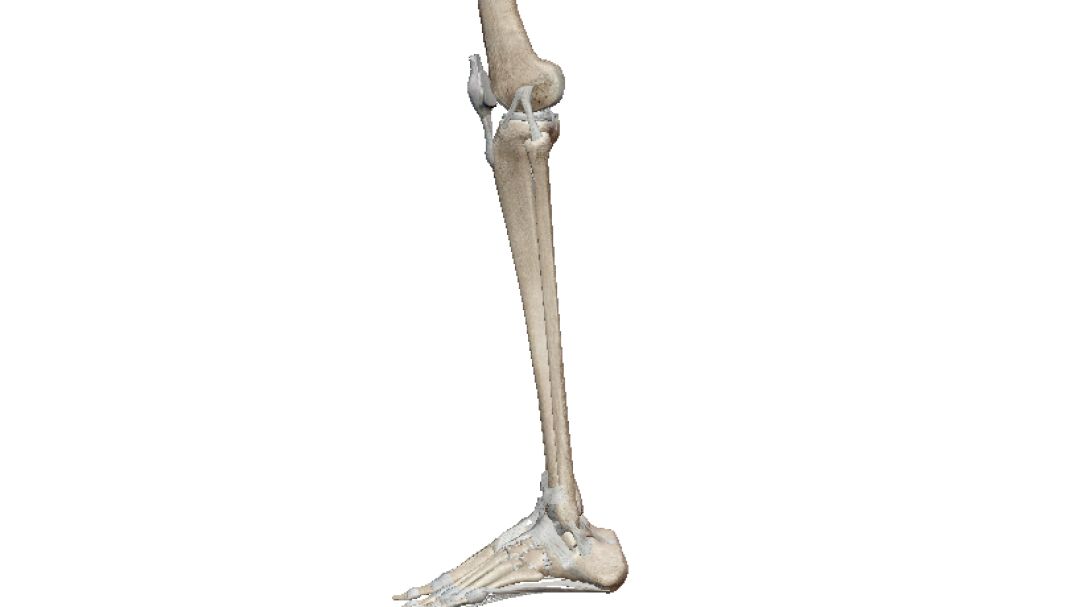 腿粗还不直小腿还外翻,怎么走路小腿才不会粗