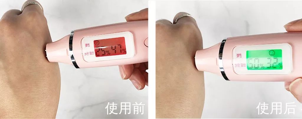 抬头纹法令纹鱼尾纹克星能管用吗,抬头纹鱼尾纹法令纹均可改善