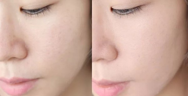 口碑最好十大气垫适合干皮,十大公认好用的气垫不脱妆的牌子