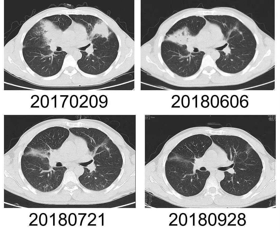热点丨诡异！男子摸过出土*物文**后反复住院8次，最后发现…