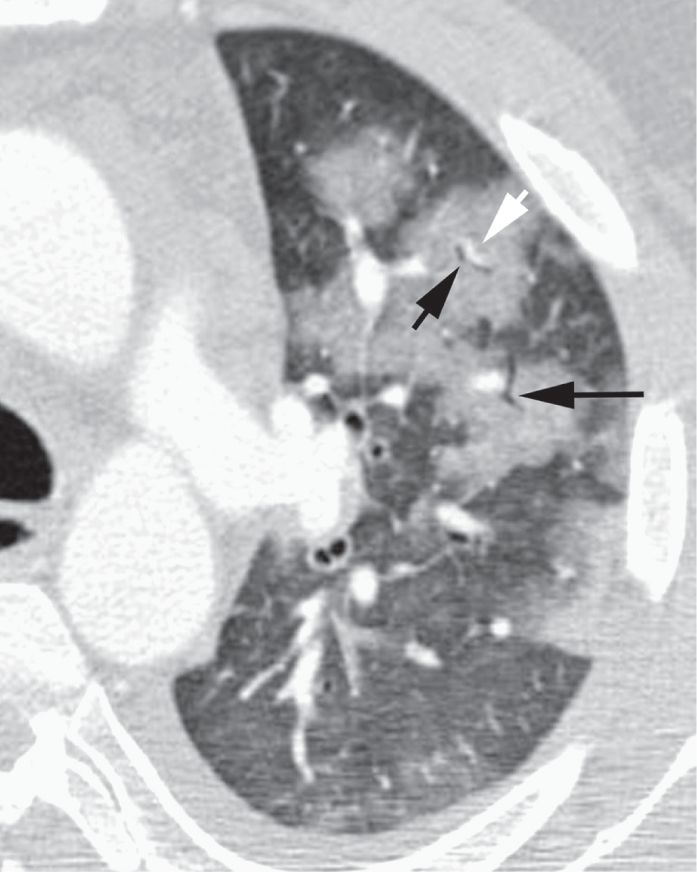 认识肺部的目的,认识呼吸器官知识点