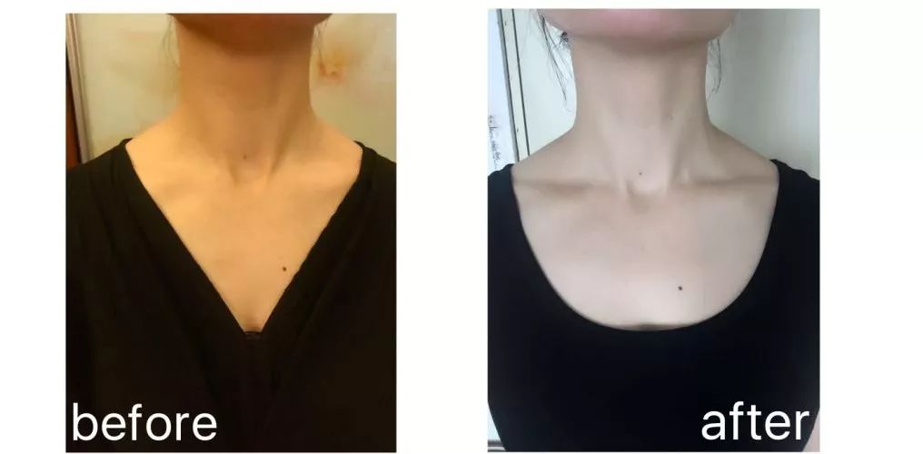 天鹅颈锁骨怎么练快速明显,天鹅颈的修炼方法视频