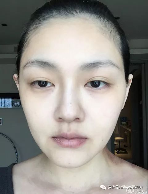 为什么我总是劝你们少用面膜~