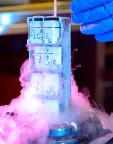 林志玲冻卵了吗,46岁林志玲自曝积极备孕