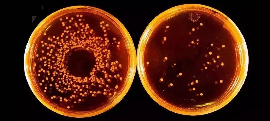 洗衣机污垢和霉菌,洗衣机加水有厕所味儿