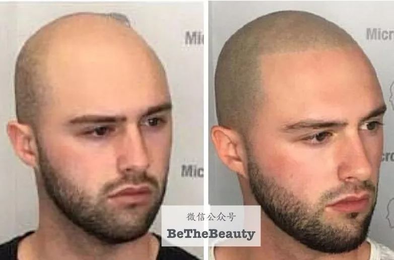 想要「换发型等于换头」？看这简单3步就可以