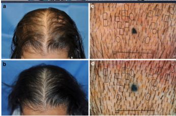 想要「换发型等于换头」？看这简单3步就可以