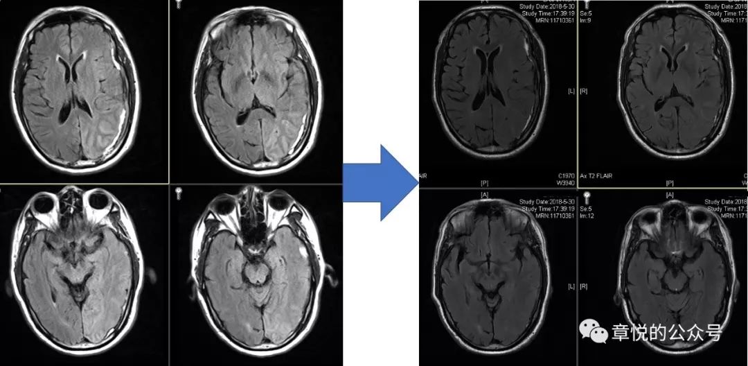 「章悦故事汇」华山“一针灵”