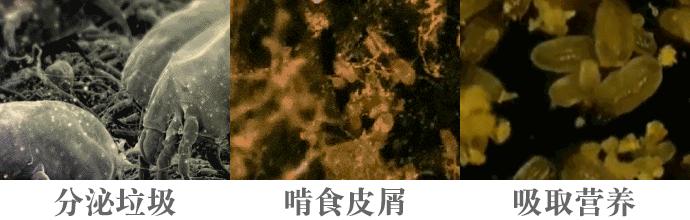 可美金箔祛痘螨虫皂,除螨皂能祛螨虫吗