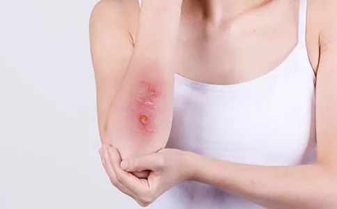 轻伤和轻微伤受什么处罚,肇事逃逸轻伤跟轻微伤怎么处罚