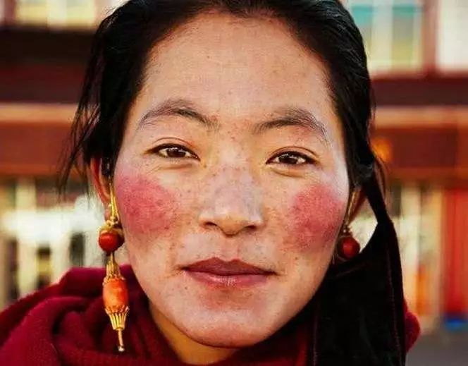 脸上的红血丝怎么处理,脸上的红血丝怎么解决