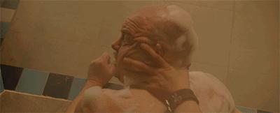 20分钟清理背部螨虫痘痘,十秒去除螨虫