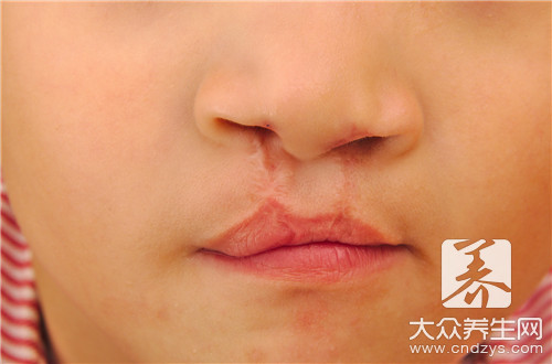 内嘴唇溃疡用什么药,嘴唇咬破溃疡怎么好得快