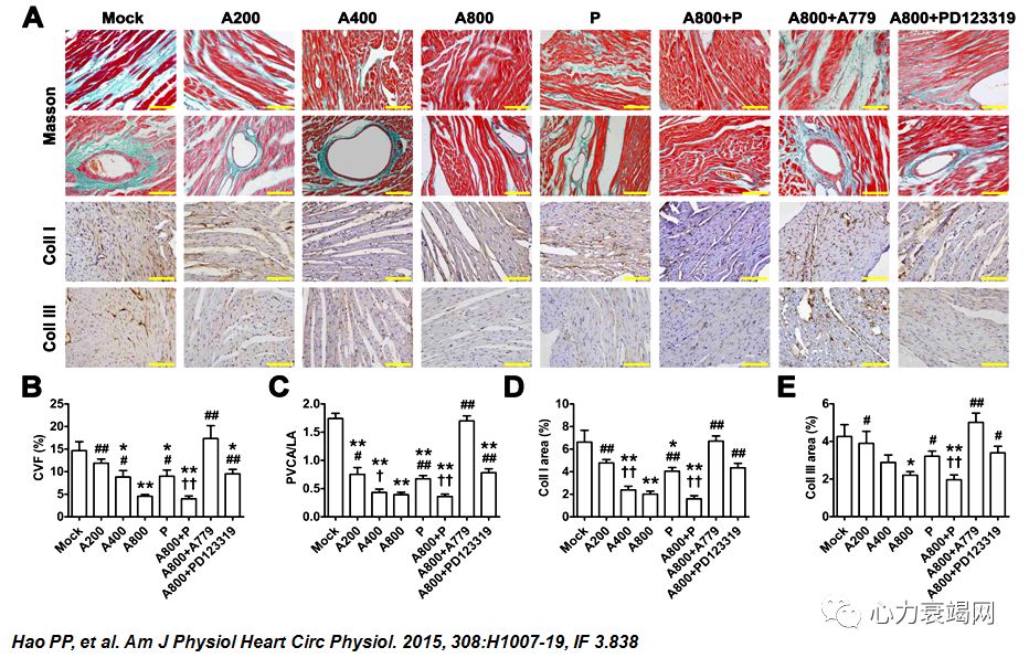 「2019CIHFC」张运教授：ADAM17—糖尿病性心肌病干预的新靶点