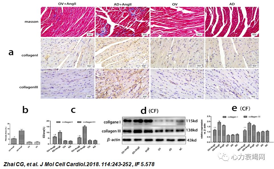 「2019CIHFC」张运教授:ADAM17—糖尿病性心肌病干预的新靶点