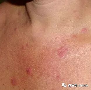 闭口看得出来吗,你真的知道什么是闭口吗