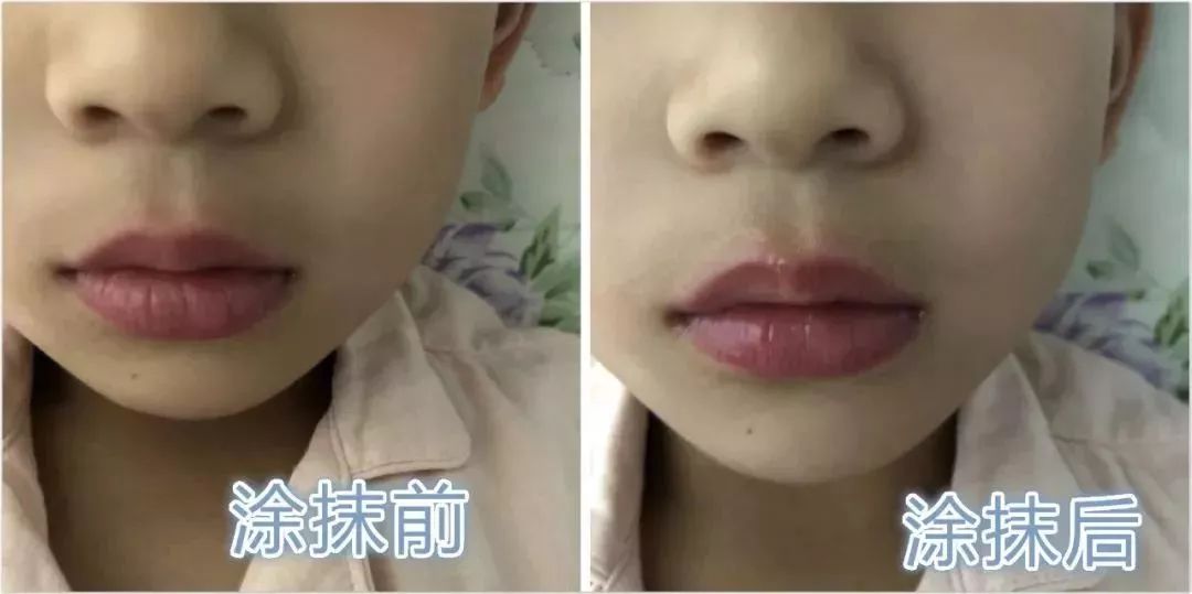 保湿、消炎、止痒、晒后修复,一管芦荟胶全搞定,宝宝也能用