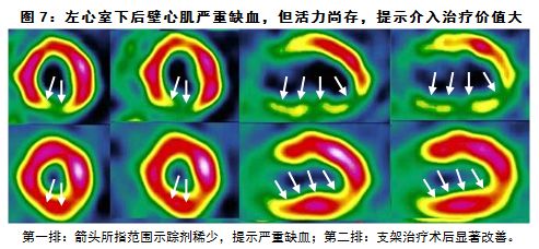 检查癌症最先进的仪器,目前最先进的查癌症的设备是