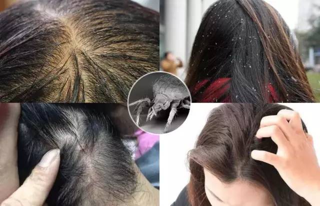 真正好用的洗发神器,一款超级好用的洗头神器