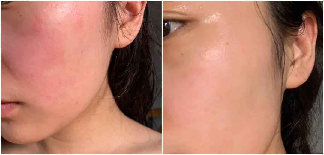 万事屋推荐|性价比最高的日本药妆之一