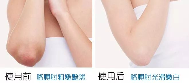 搓背长条沐浴刷,懒人浴室搓背刷