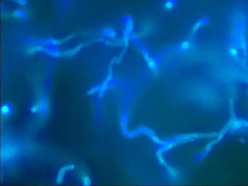 8个月的宝宝竟然得了“香港脚”！医生：梅雨季尤其要多注意