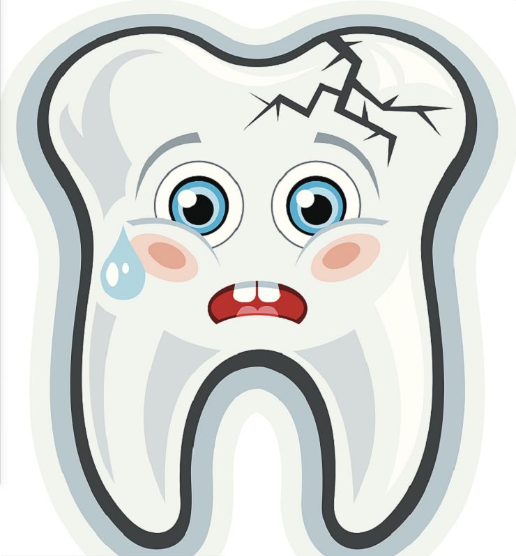 根管治疗加牙套多少钱,根管治疗后还要做牙套吗