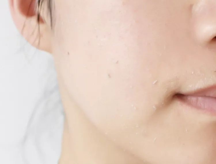 脸上搓出3斤泥！难怪又黄又暗又黑头！10秒给脸蛋“剥壳”，厉害