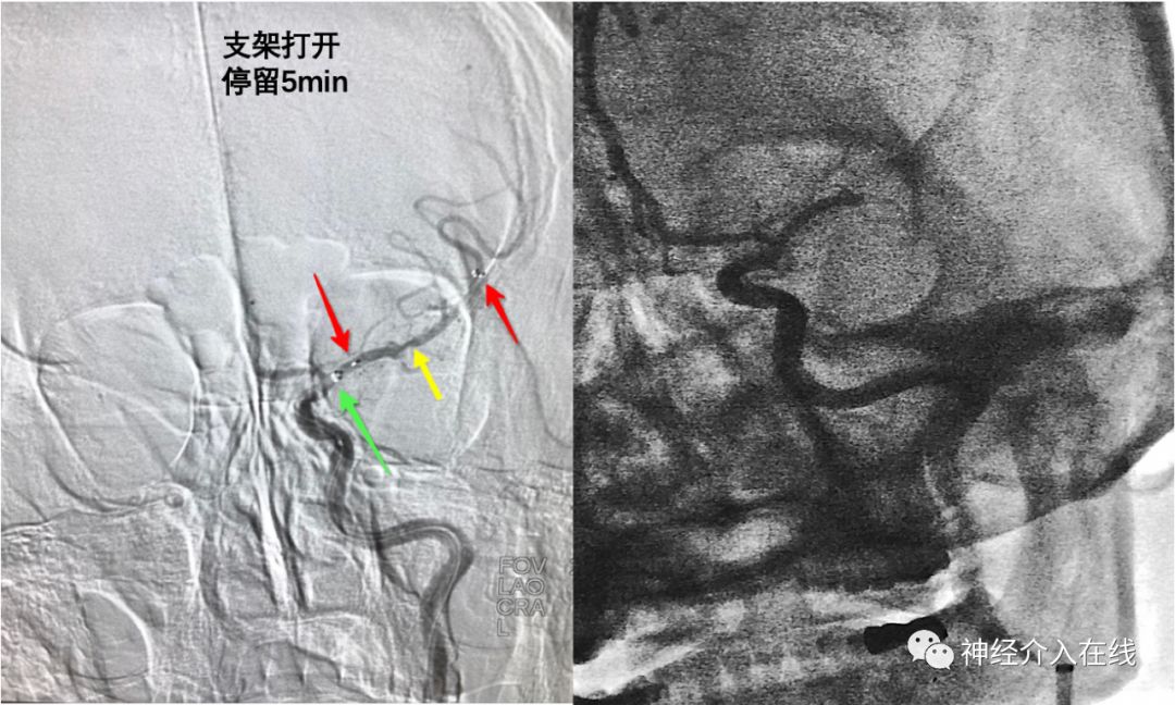 旭日东升第三式,旭日东升第三部