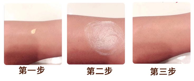 足癣湿疹用什么药膏最有效,皮炎湿疹足癣