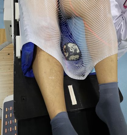 患者初次放疗注意事项,放疗体位固定跟ct模拟需要多久