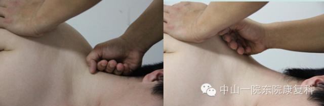 筋膜的康复训练方法,12条筋膜链解析及治疗手法