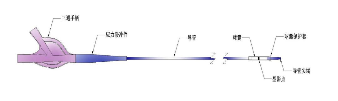 Reco特约·第10期｜国产组合助力取栓“一把通”——Ewata球囊导引导管联合Reco支架取栓分享