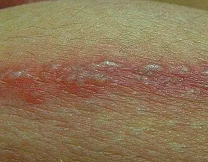 牙疼嗓子疼挂什么科,牙疼挂口腔医院的什么科