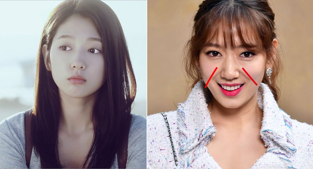 法令纹又黑又长,法令纹又深又长好吗