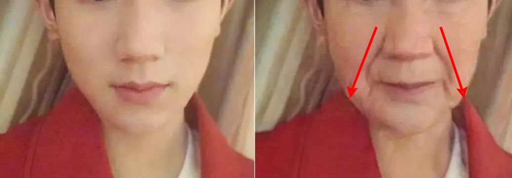 三十岁就有眉间纹法令纹怎么办,30岁法令纹眉心纹深