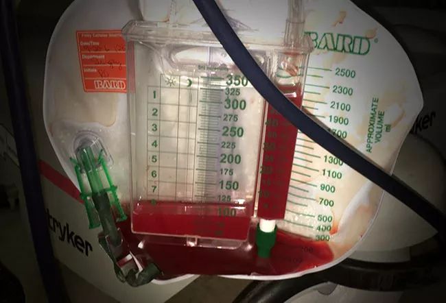 尿液各种颜色都代表什么病,尿液是五颜六色的怎么回事