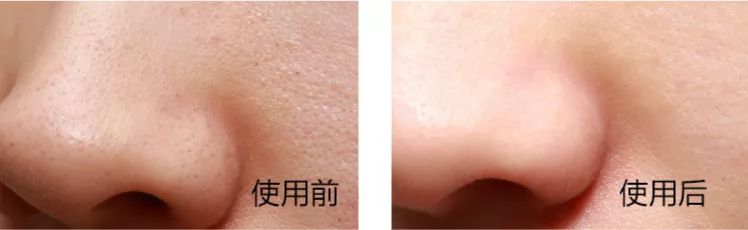 娆ц幈闆呮帶娌圭偔鐖芥礂闈㈠ザ鐢峰コ閫氱敤,娆ц幈闆呯敺澹礂闈㈠ザ鎺ф补娓呯埥娴嬭瘎