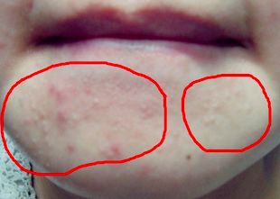 整容明星脸翻车现场,明星整容翻车名场面