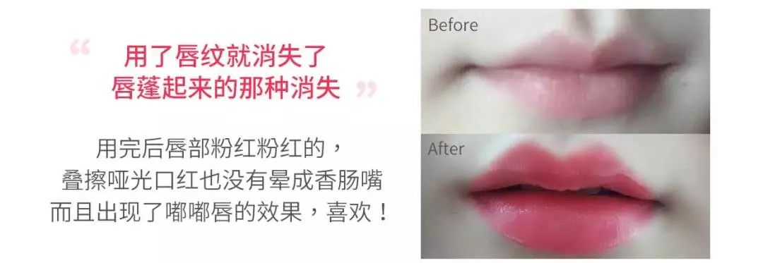 丰唇怎样让唇边更立体,适合丰唇的唇形